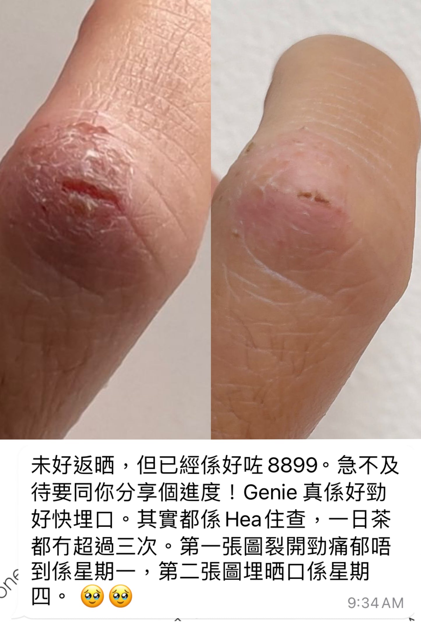 GENIE 有機癒合膏