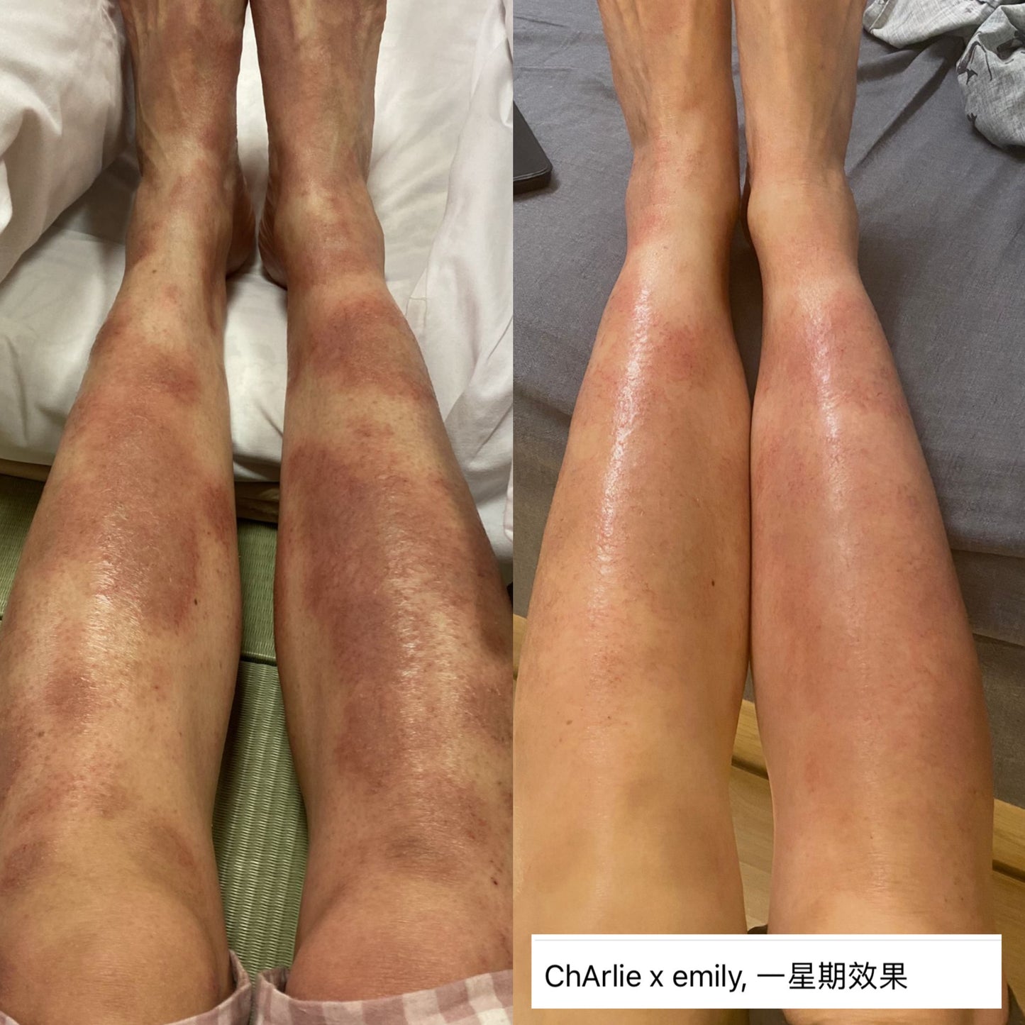CHARLIE 有機退紅啫喱