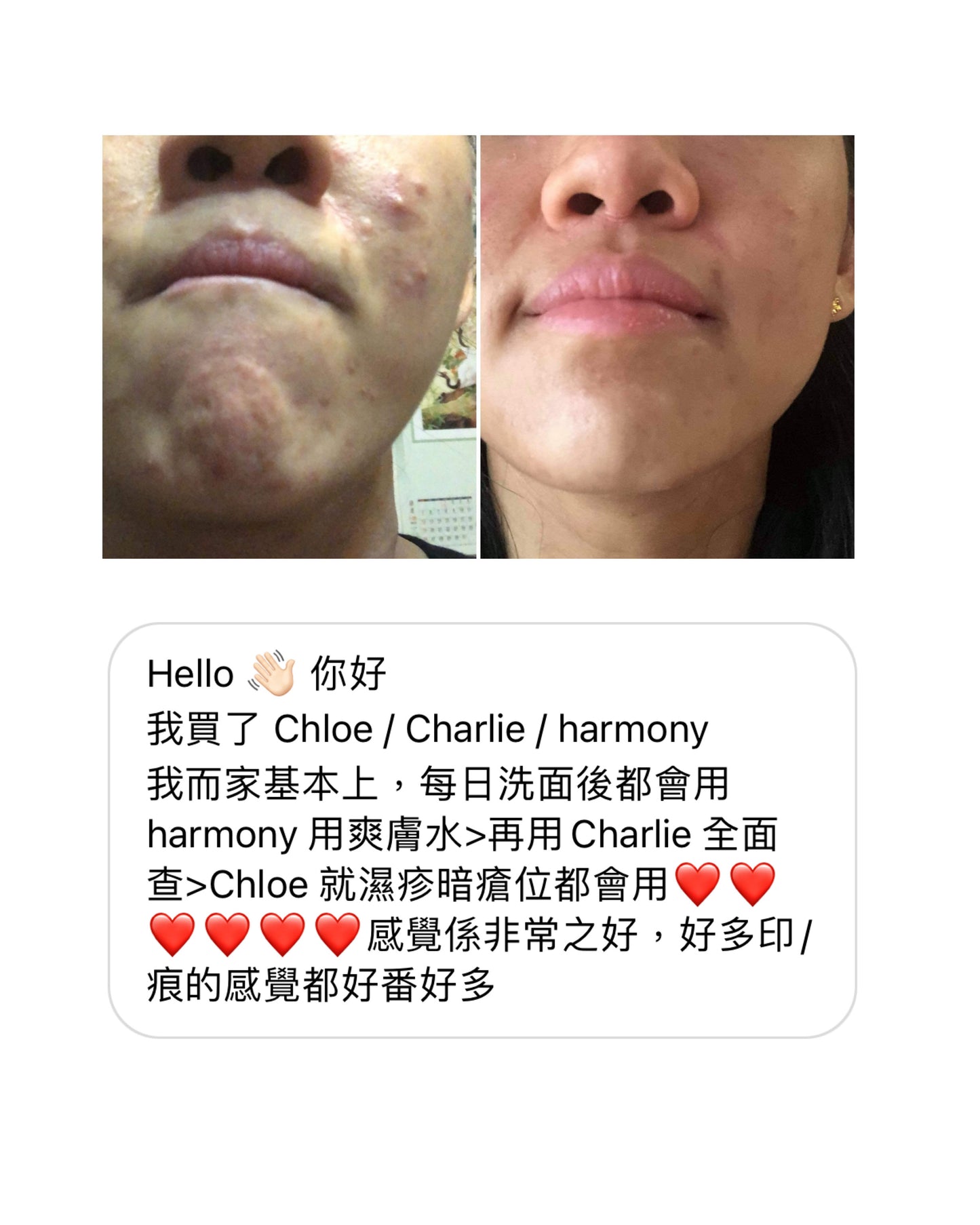 Red Bygones 退紅抗敏套裝
