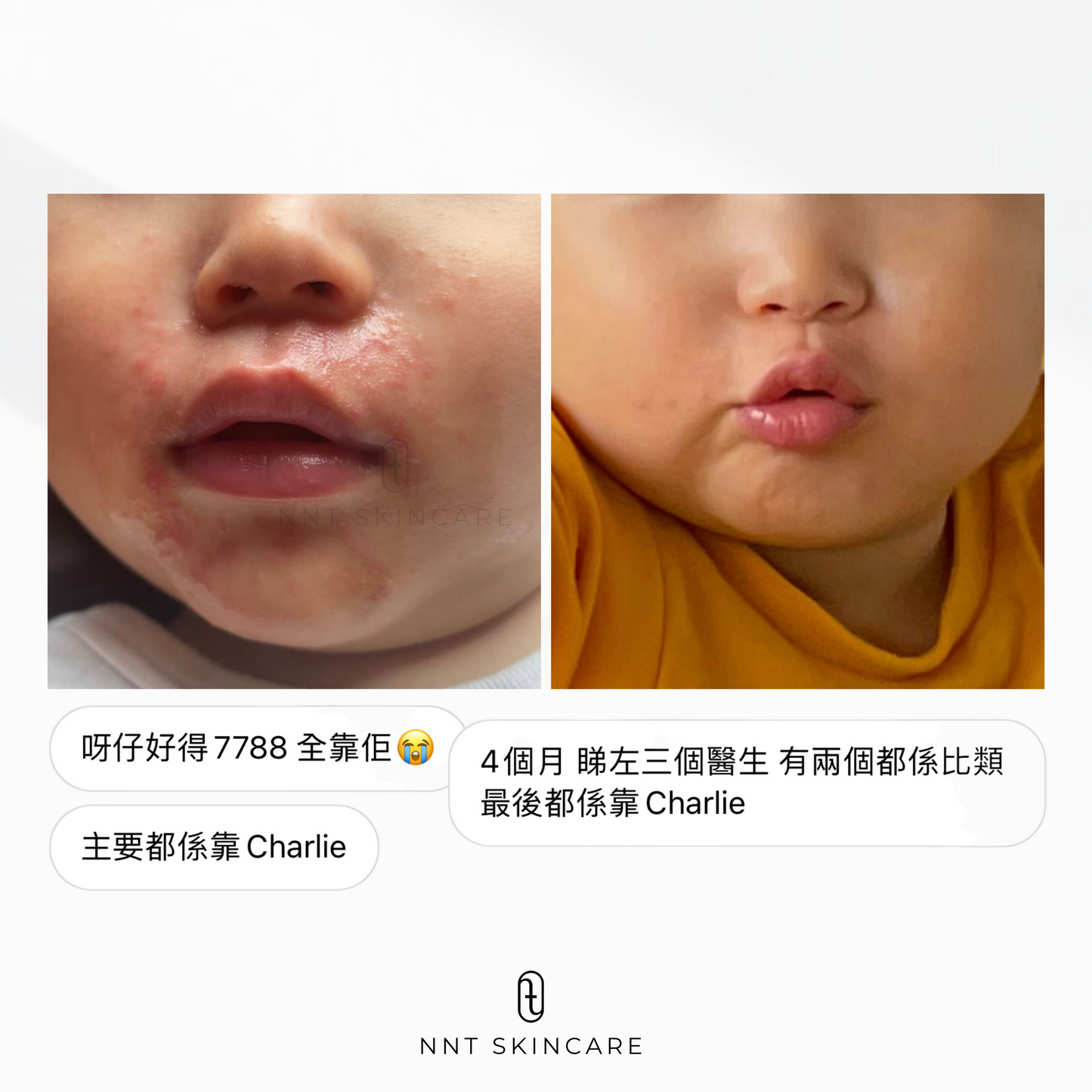 CHARLIE 有機退紅啫喱