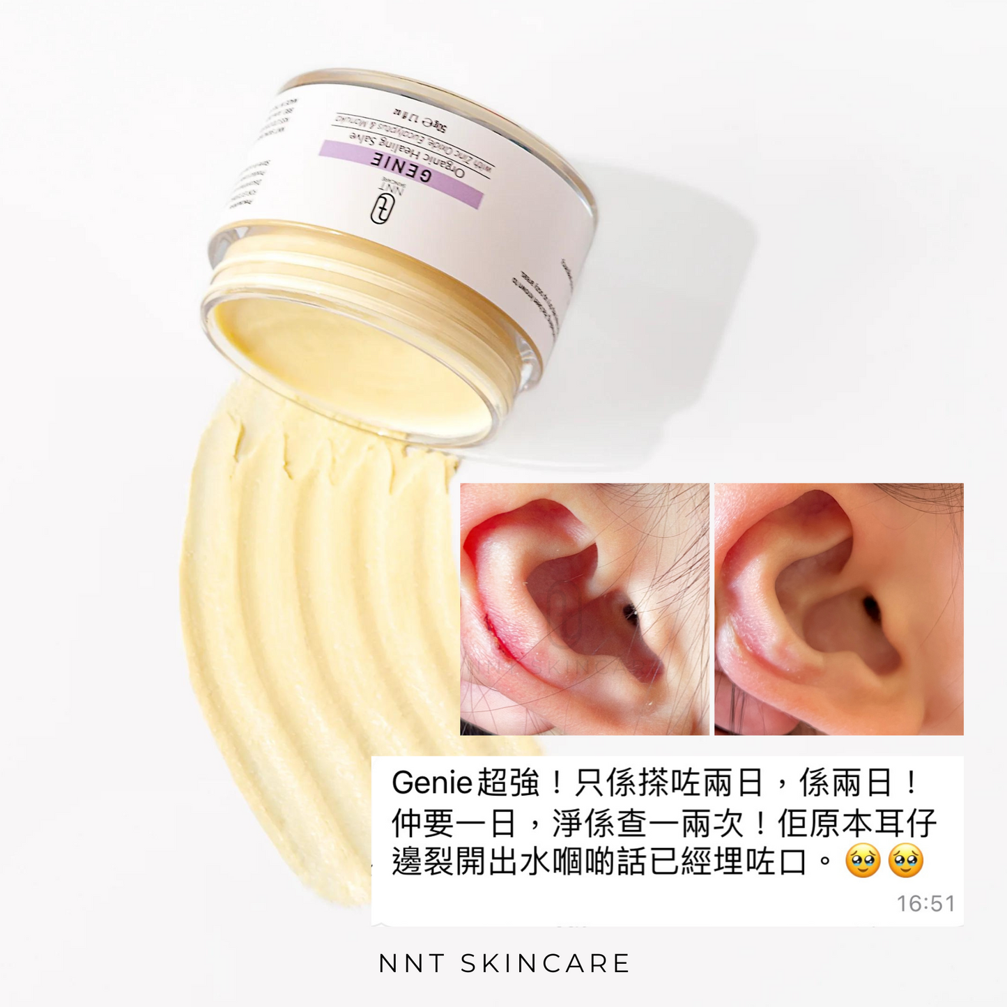 GENIE 有機癒合膏