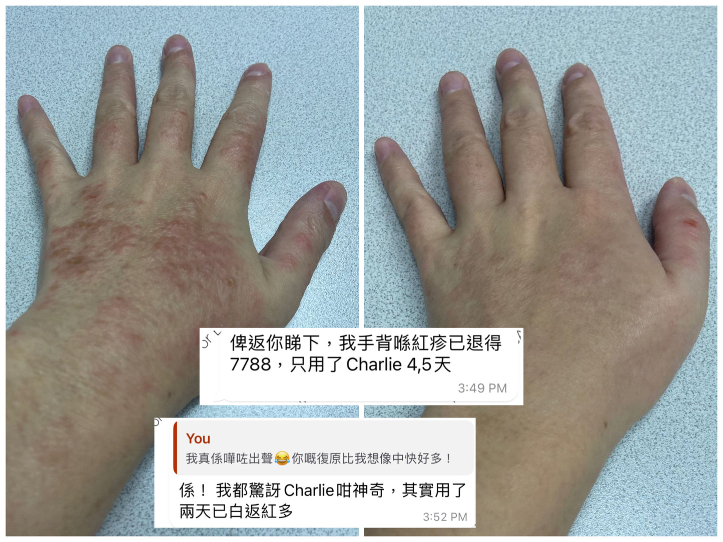 CHARLIE 有機退紅啫喱