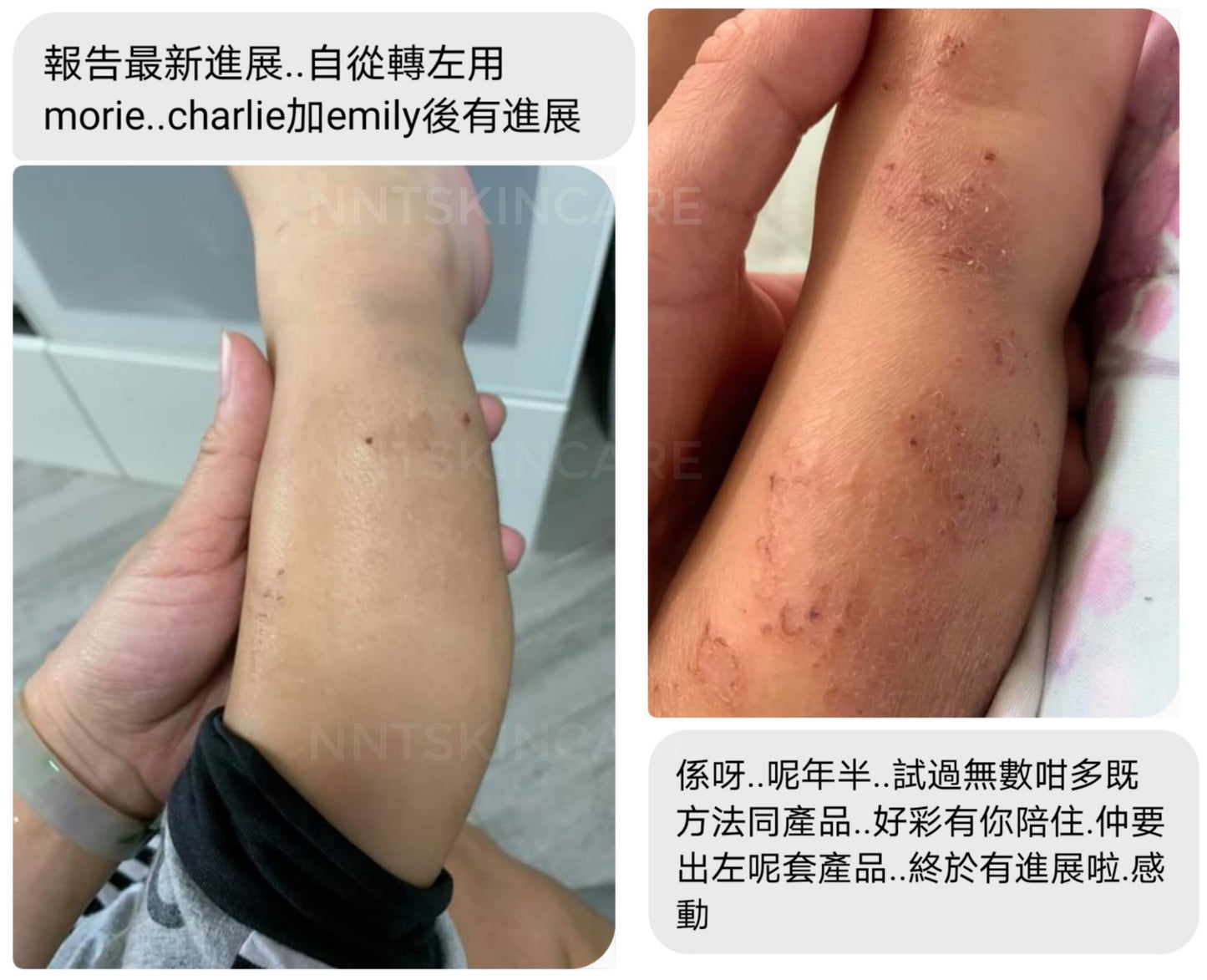 EMILY 有機舒緩修護油