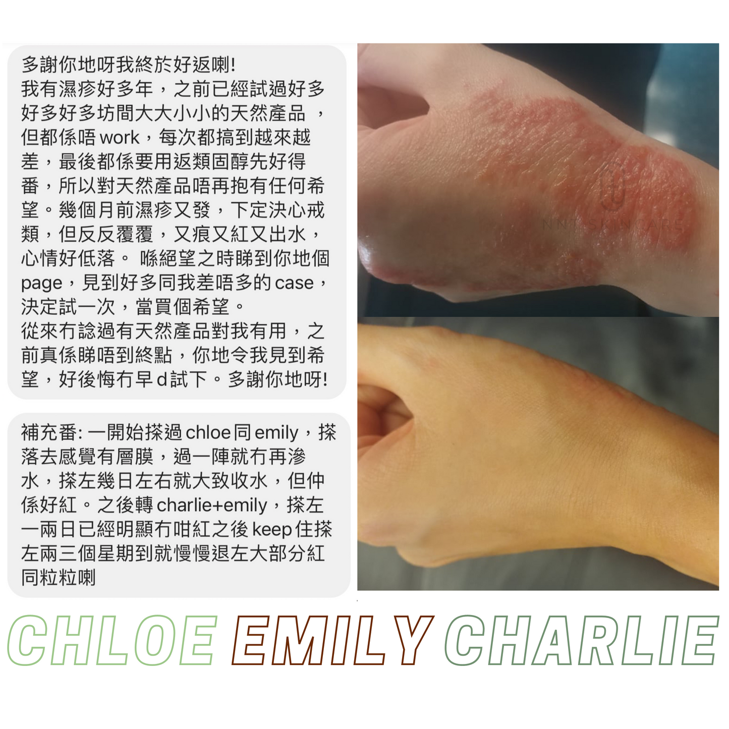 CHLOE 有機急救啫喱