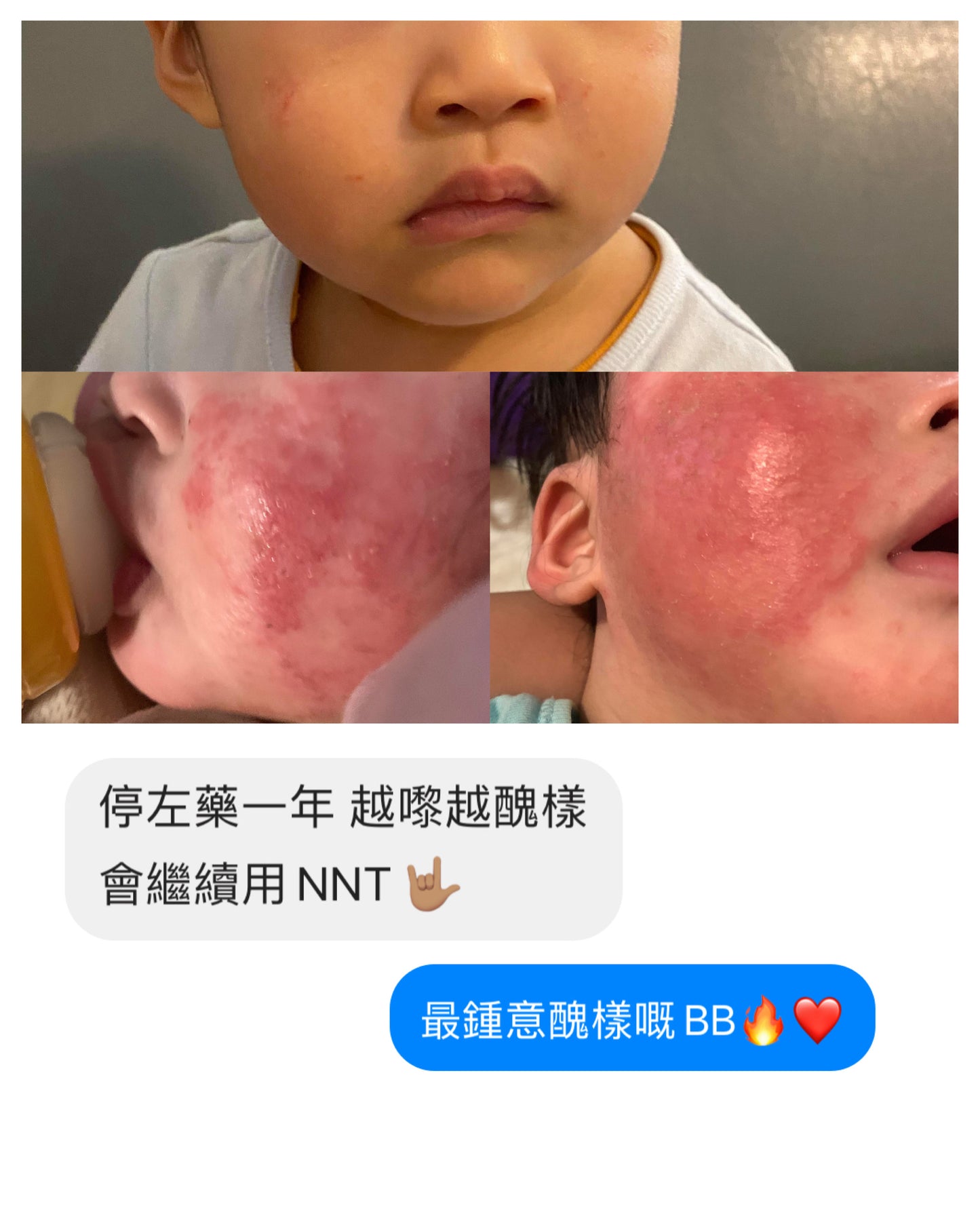 CHARLIE 有機退紅啫喱
