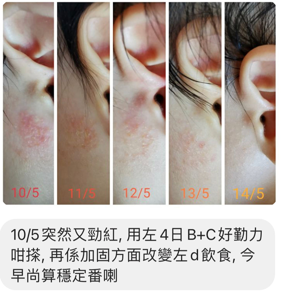 CHLOE 有機急救啫喱