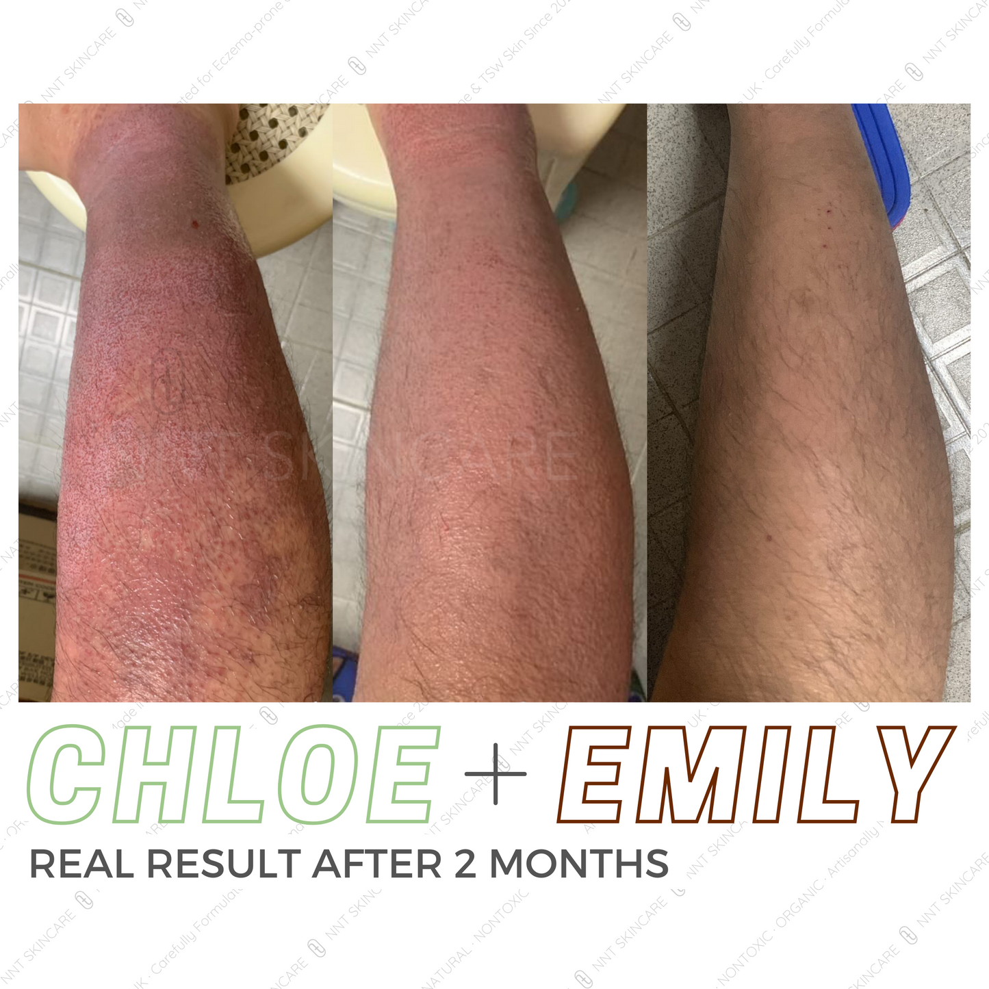 CHLOE 有機急救啫喱