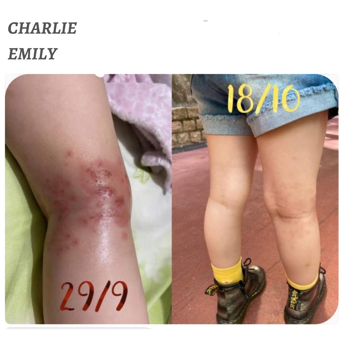 EMILY 有機舒緩修護油