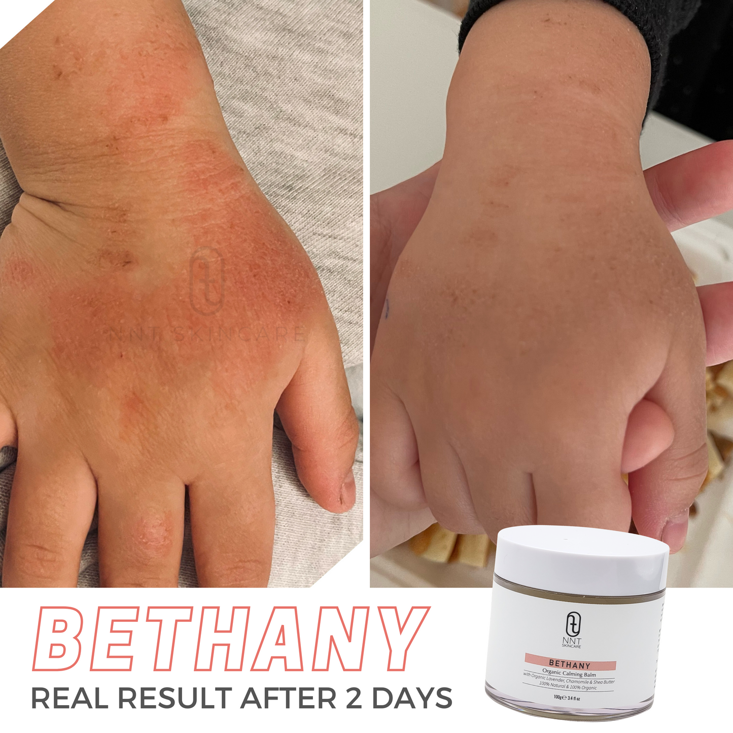 BETHANY 有機鎮靜修護霜