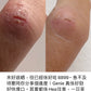 GENIE 有機癒合膏